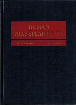 Human Transplantation