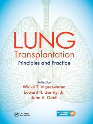 Immagine del venditore per Lung Transplantation (Paperback) venduto da CitiRetail