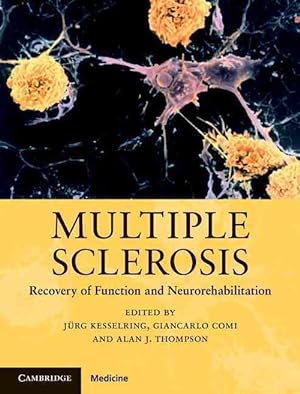 Bild des Verkufers fr Multiple Sclerosis (Hardcover) zum Verkauf von CitiRetail