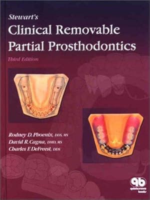 Bild des Verkufers fr Stewart's Clinical Removable Partial Prosthodontics zum Verkauf von Giant Giant