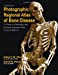 Immagine del venditore per Photographic Regional Atlas of Bone Disease: A Guide to Pathologic and Normal Variations in the Human Skeleton venduto da Pieuler Store