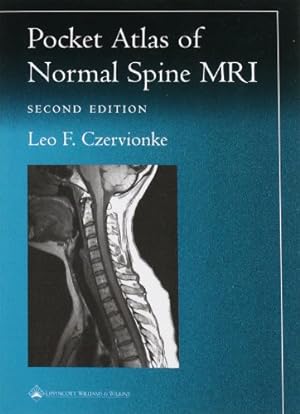Seller image for Pocket Atlas of Spinal MRI (Radiology Pocket Atlas Series) for sale by Pieuler Store
