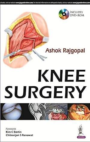 Bild des Verkufers fr Knee Surgery zum Verkauf von WeBuyBooks