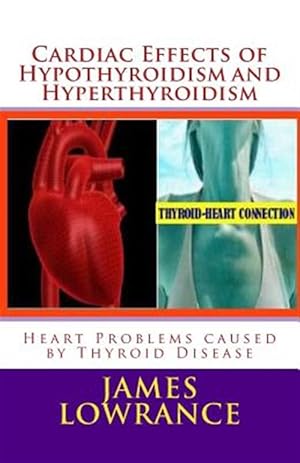 Immagine del venditore per Cardiac Effects of Hypothyroidism and Hyperthyroidism : Heart Problems Caused by Thyroid Disease venduto da GreatBookPrices