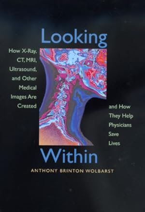 Bild des Verkufers fr Looking Within : How X-Ray, Ct, Mri, Ultrasound, and Other Medical Images Are Created, and How They Help Physicians Save Lives zum Verkauf von GreatBookPricesUK