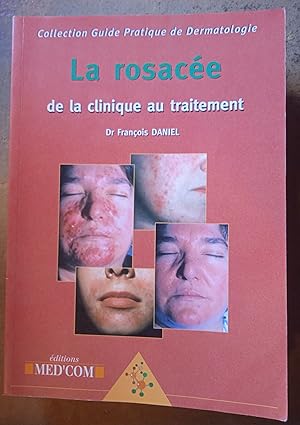 Seller image for La rosace - de la clinique au traitement for sale by Les Kiosques