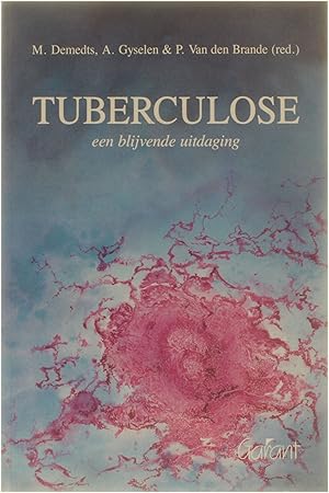 Bild des Verkufers fr Tuberculose - een blijvende uitdaging zum Verkauf von Untje.com