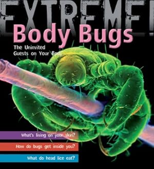 Immagine del venditore per Extreme Science: Body Bugs!: The Uninvited Guests on Your Body venduto da WeBuyBooks