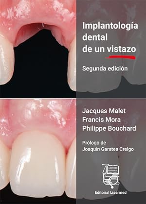 Bild des Verkufers fr Implantologa dental de un vistazo zum Verkauf von Vuestros Libros