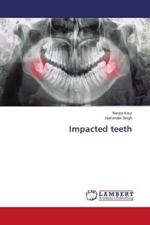 Seller image for Impacted teeth for sale by AHA-BUCH GmbH