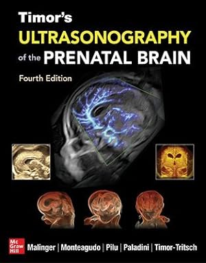 Image du vendeur pour Ultrasonography of the Prenatal Brain mis en vente par GreatBookPrices