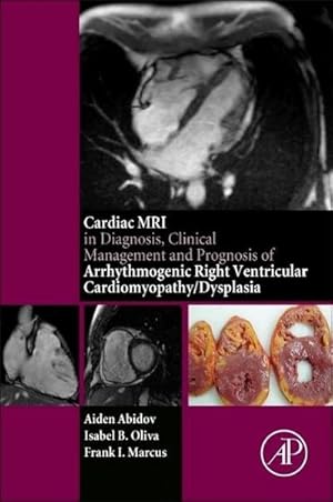 Seller image for Cardiac MRI in Diagnosis, Clinical Management, and Prognosis of Arrhythmogenic Right Ventricular Cardiomyopathy/Dysplasia for sale by AHA-BUCH GmbH