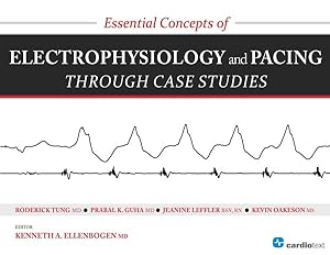 Bild des Verkufers fr Essential Concepts of Electrophysiology and Pacing Through Case Studies zum Verkauf von GreatBookPricesUK