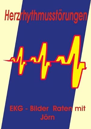 Seller image for Herzrhythmusstrungen : EKG - Bilder Raten mit Jrn for sale by Smartbuy