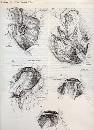 Seller image for LAMINA V20120: Colectomia total 3 for sale by EL BOLETIN