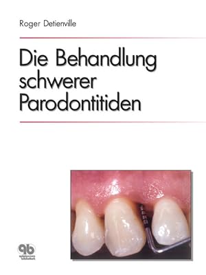 Seller image for Die Behandlung schwerer Parodontitiden for sale by Studibuch