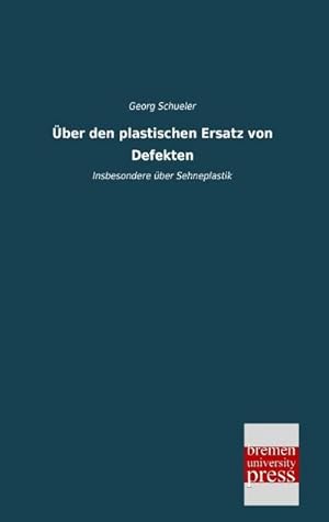 Seller image for ber den plastischen Ersatz von Defekten : Insbesondere ber Sehneplastik for sale by Smartbuy