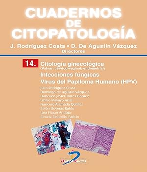 Immagine del venditore per Citologa ginecolgica Infecciones fngicas. Virus del Papiloma Humano (HPV) venduto da Imosver