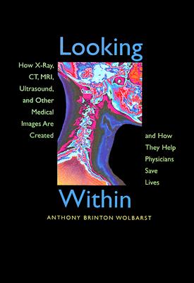 Immagine del venditore per Looking Within: How X-Ray, Ct, Mri, Ultrasound, and Other Medical Images Are Created, and How They Help Physicians Save Lives (Paperback or Softback) venduto da BargainBookStores
