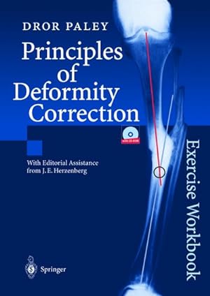 Imagen del vendedor de Principles of Deformity Correction a la venta por BuchWeltWeit Ludwig Meier e.K.