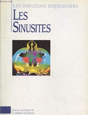 Seller image for Les infections respiratoires : Les sinusites for sale by Le-Livre