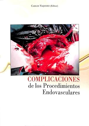 Imagen del vendedor de COMPLICACIONES DE LOS PROCEDIMIENTOS ENDOVASCULARES. a la venta por Librera Smile Books