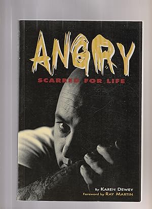 Seller image for ANGRY. Scarred For Life for sale by BOOK NOW