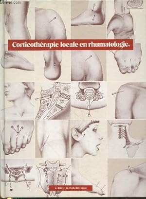 Bild des Verkufers fr Corticothrapie locale en rhumatologie zum Verkauf von Le-Livre