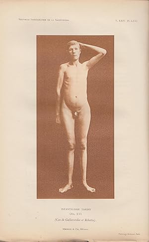 Imagen del vendedor de Nouvelle Iconographie de la Salptrire n 6 novembre-dcembre 1911 a la venta por PRISCA