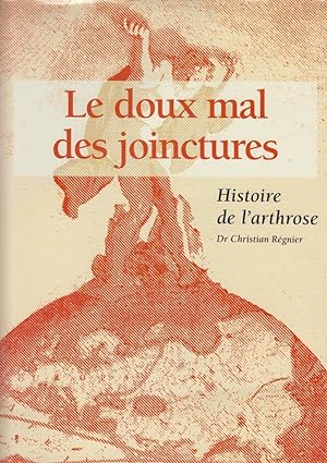 Seller image for Le doux mal des joinctures [sic] : histoire de l'arthrose for sale by PRISCA