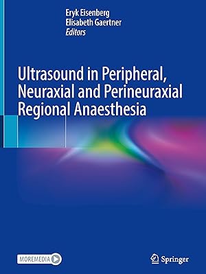 Seller image for Ultrasound in Peripheral, Neuraxial and Perineuraxial Regional Anaesthesia for sale by moluna
