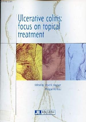 Bild des Verkufers fr Ulcerative colitis : focus on topical treatment. zum Verkauf von Le-Livre