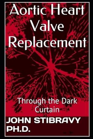 Seller image for Aortic Heart Valve Replacement (Paperback) for sale by Grand Eagle Retail
