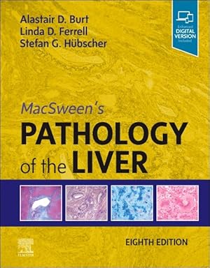 Seller image for Macsween's Pathology of the Liver for sale by GreatBookPrices