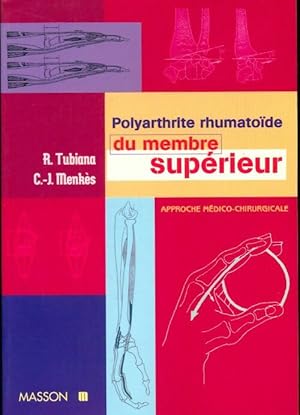 Bild des Verkufers fr Polyarthrite rhumato?de du membre superieur approche medico-chirurgicale - Raoul Tubiana zum Verkauf von Book Hmisphres