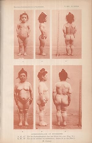 Imagen del vendedor de Nouvelle Iconographie de la Salptrire - tome XIV, 1901, publie sous la direction du professeur Charcot a la venta por PRISCA