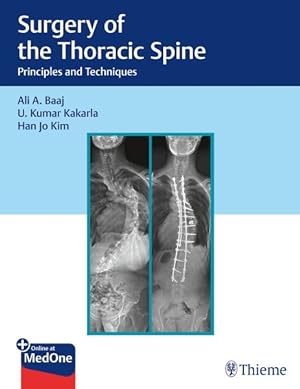 Bild des Verkufers fr Surgery of the Thoracic Spine : Principles and Techniques zum Verkauf von GreatBookPrices