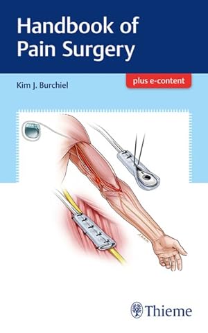 Immagine del venditore per Handbook of Pain Surgery venduto da GreatBookPrices