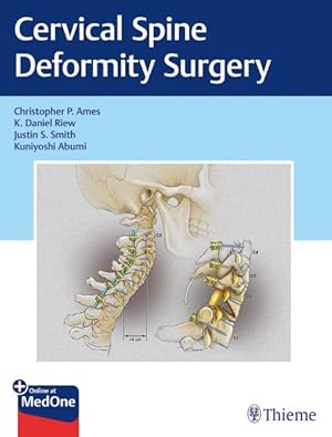 Bild des Verkufers fr Cervical Spine Deformity Surgery zum Verkauf von GreatBookPrices