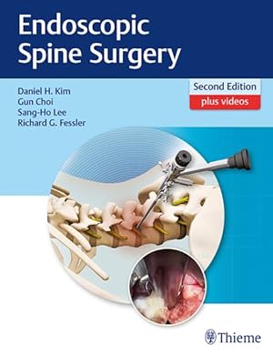 Bild des Verkufers fr Endoscopic Spine Surgery zum Verkauf von GreatBookPrices