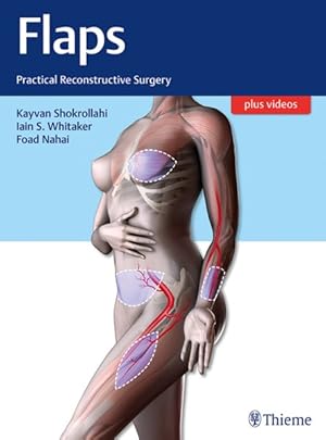 Seller image for Flaps : Practical Reconstructive Surgery for sale by GreatBookPrices