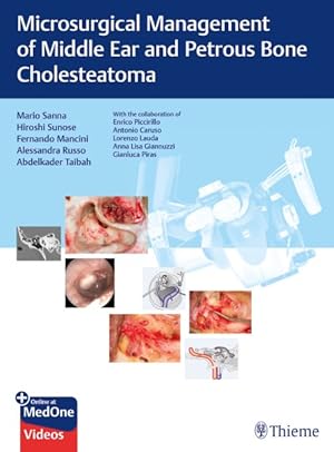 Bild des Verkufers fr Microsurgical Management of Middle Ear and Petrous Bone Cholesteatoma zum Verkauf von GreatBookPrices