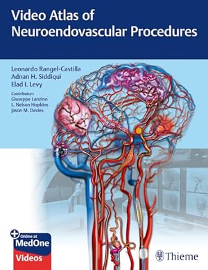 Imagen del vendedor de Video Atlas of Neuroendovascular Procedures a la venta por GreatBookPrices