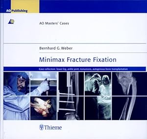 Immagine del venditore per Minimax Fracture Fixation : Case Collection: Lower Leg - Ankle Joint - Nonunions - Autogenous Bone Transplantation venduto da GreatBookPrices