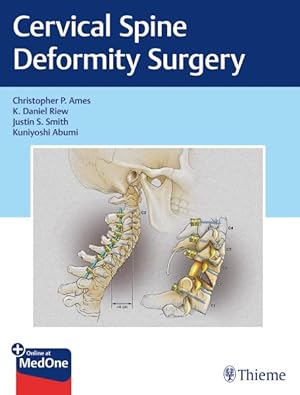 Imagen del vendedor de Cervical Spine Deformity Surgery a la venta por GreatBookPrices