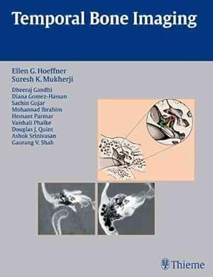 Seller image for Temporal Bone Imaging for sale by GreatBookPrices