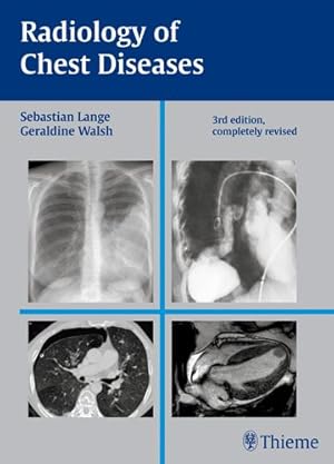Seller image for Radiology of Chest Diseases for sale by GreatBookPrices