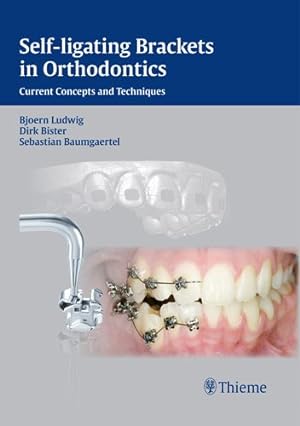 Seller image for Self-Ligating Brackets in Orthodontics : Current Concepts and Techniques for sale by GreatBookPrices