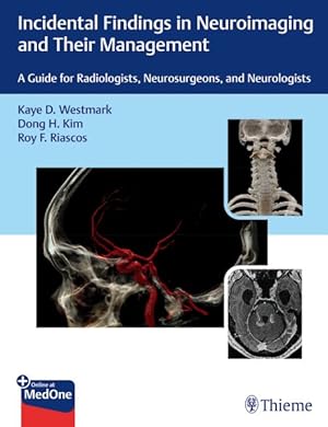 Seller image for Incidental Findings in Neuroimaging and Their Management : A Guide for Radiologists, Neurosurgeons, and Neurologists for sale by GreatBookPrices