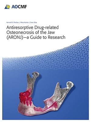 Bild des Verkufers fr Antiresorptive Drug-Related Osteonecrosis of the Jaw : ARONJ - a Guide to Research zum Verkauf von GreatBookPrices